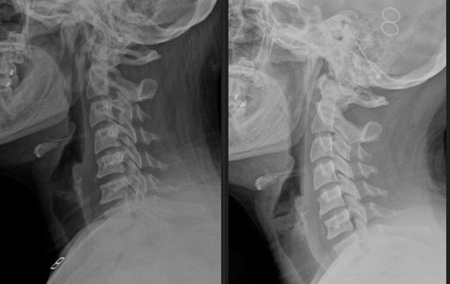Denver Chiro